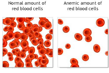 anemia itching