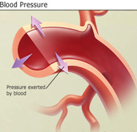 blood pressure, bp, pkd, polycystic kidney disease, hypertension, excercise, alkalinity, alkaline diet, potassium citrate