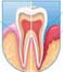 tooth pain pld pkd
